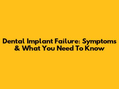 Dental Implant Failure: Symptoms & What You Need To Know