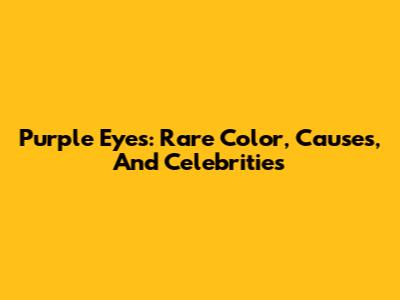 Purple Eyes: Rare Color, Causes, And Celebrities