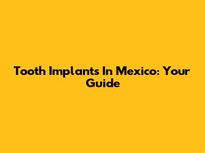 Tooth Implants In Mexico: Your Guide